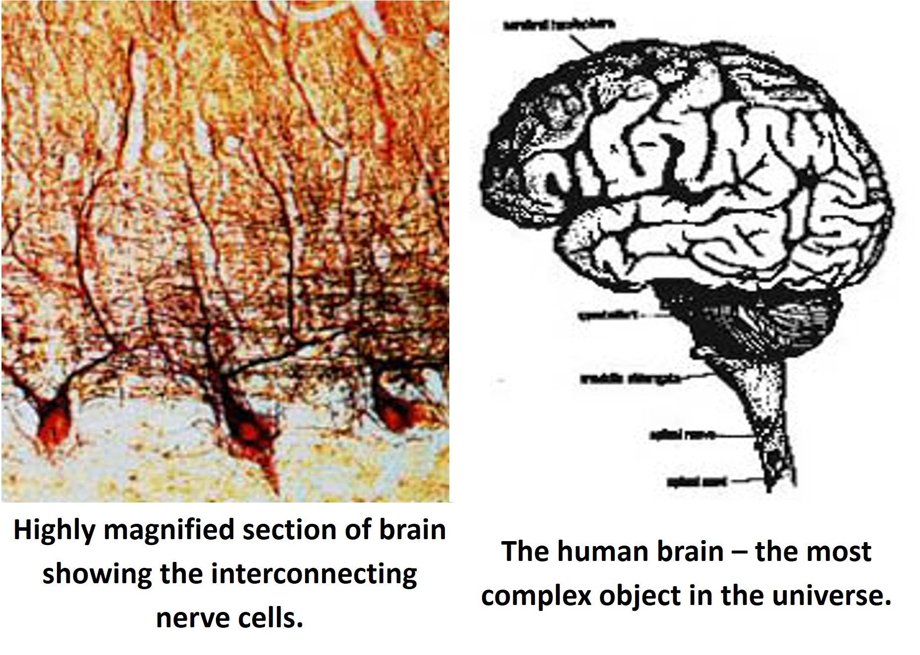 The Human Brain