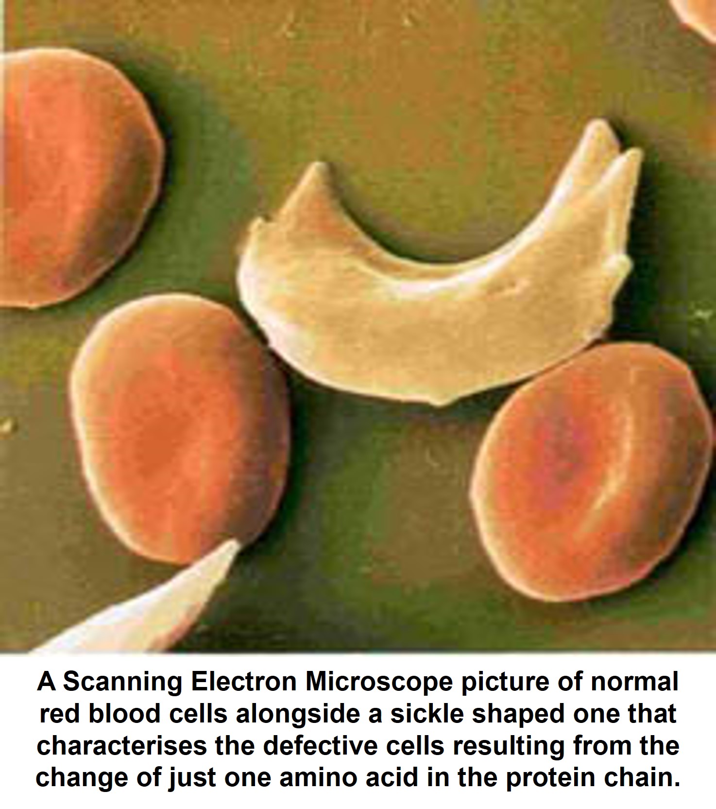 Scanning Electron Microscope of normal red blood cells